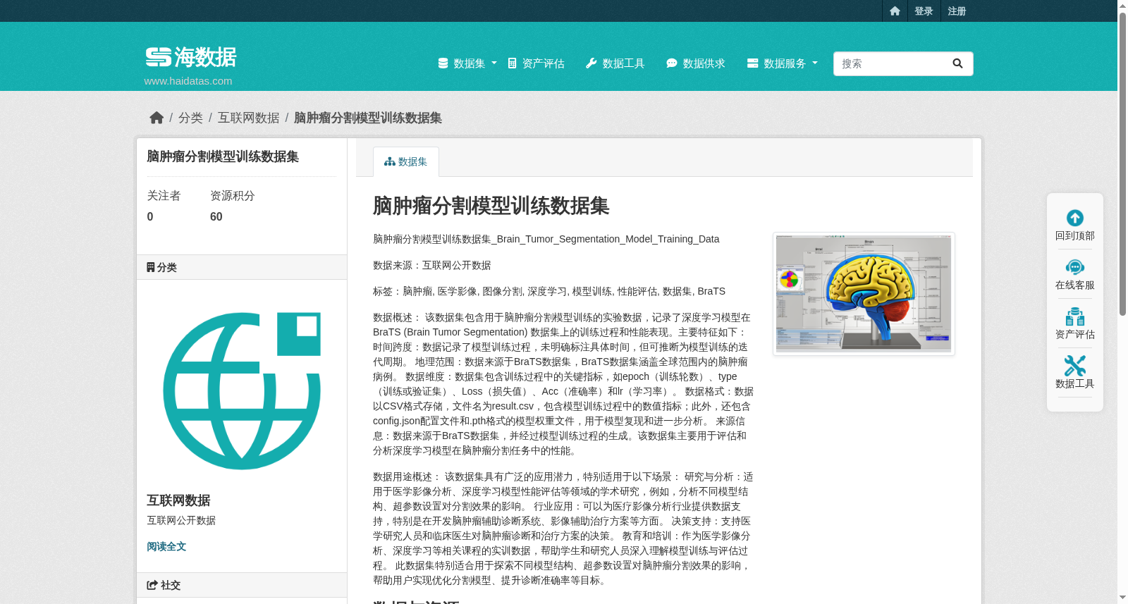 脑肿瘤分割模型训练数据集