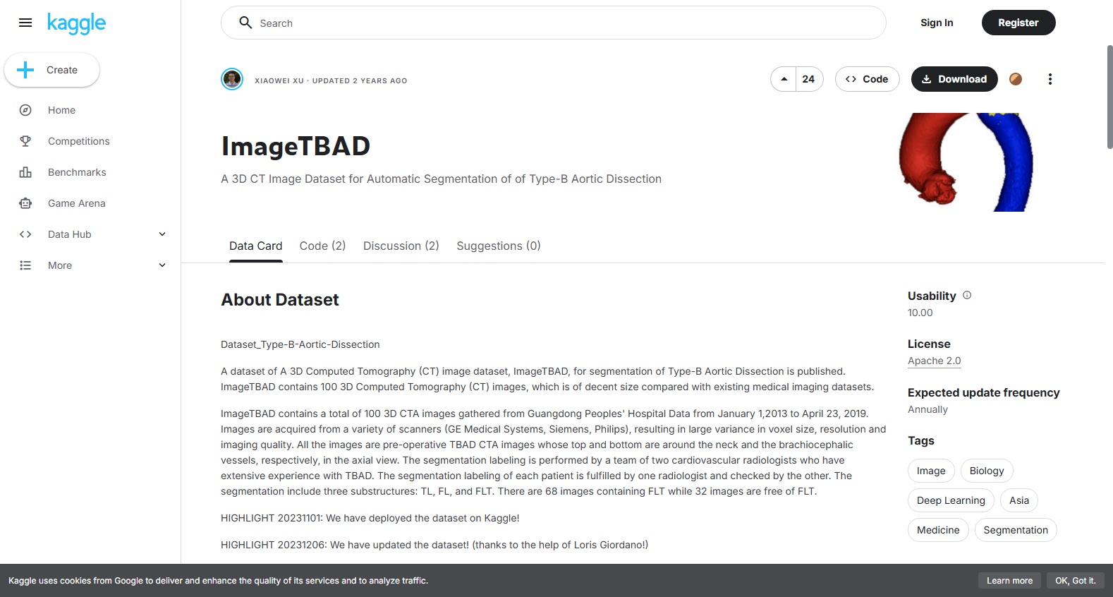 ImageTBAD B型主动脉夹层CTA数据集