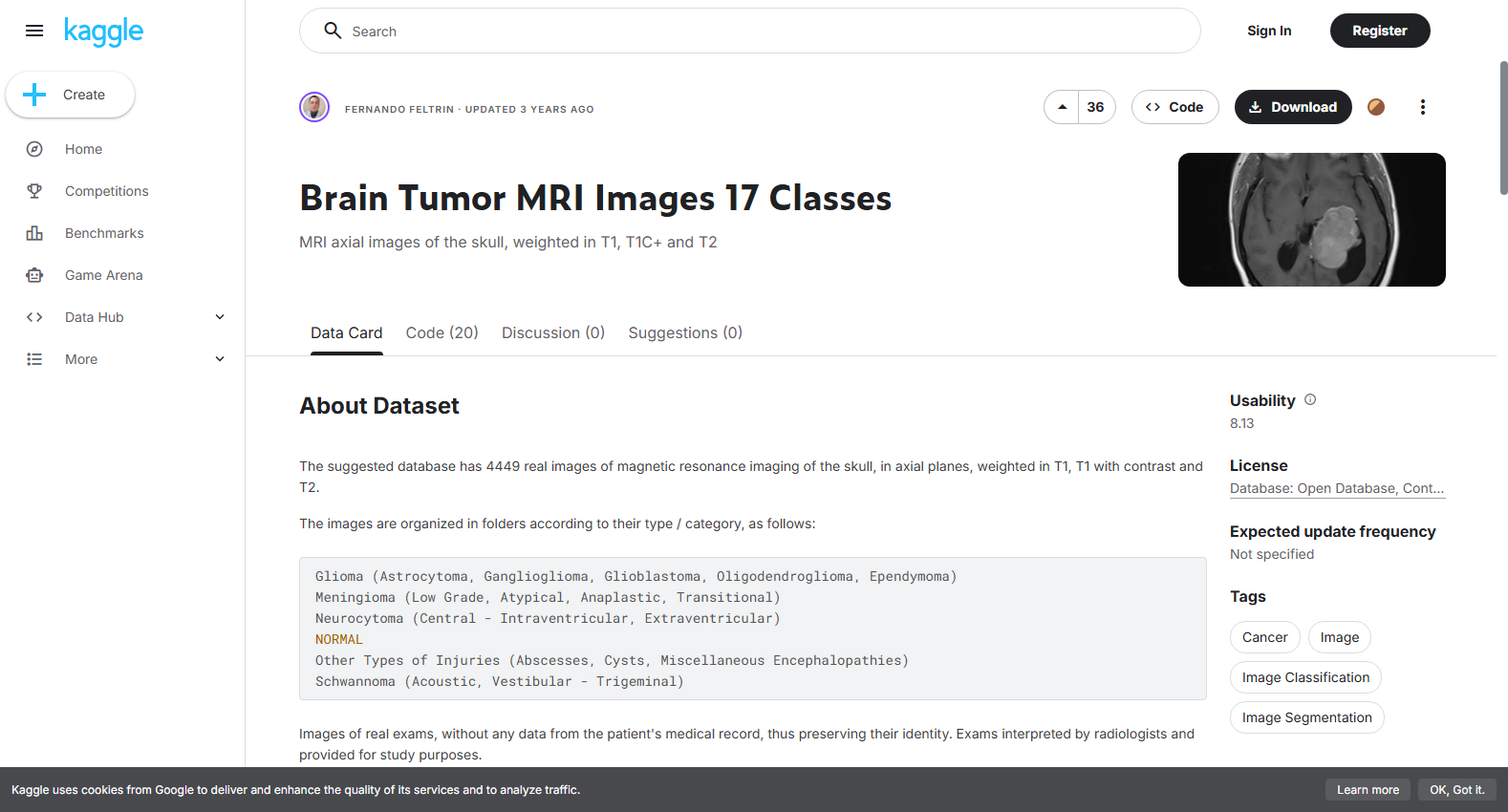 脑肿瘤MRI 17类图像数据集