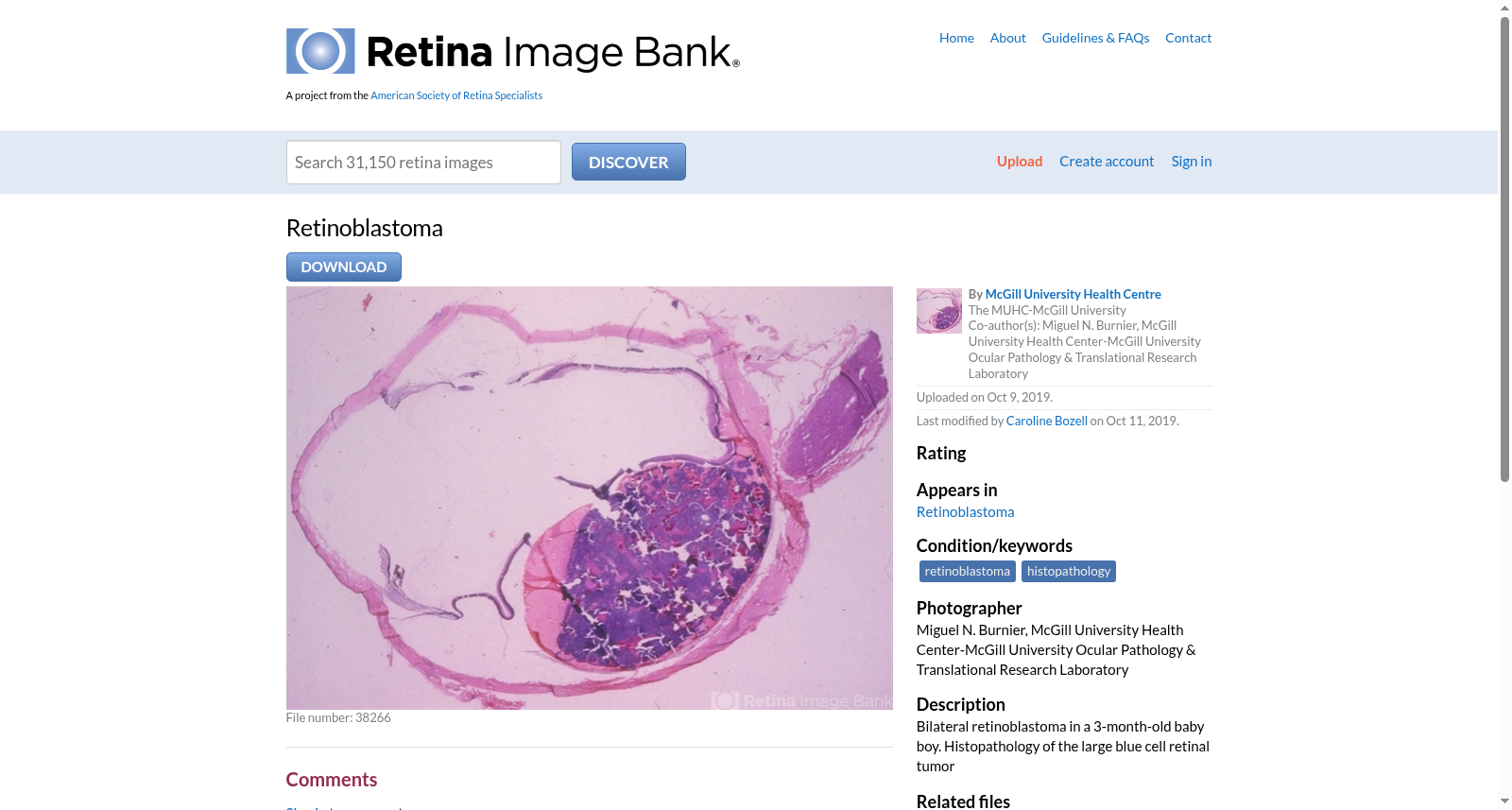 Retina Image Bank视网膜母细胞瘤图像