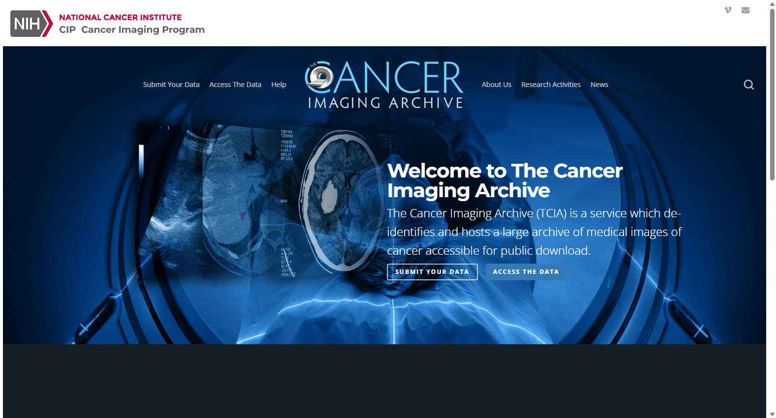 TCIA 乳腺癌多参数 MRI 数据集 (含乳头受累病例)